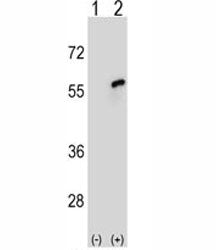 Western blot analysis of CDC20 antibody and 293 cell lysate either nontransfected (Lane 1) or transi