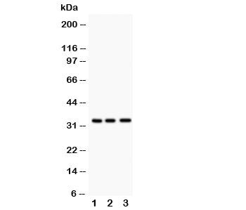 Western blot testing of MPG antibody and Lane 1: rat liver; 2: human HeLa; 3: (h) Jurkat. Predicted