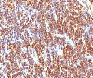 IHC testing of formalin-fixed, paraffin-embedded human tonsil with SUMO-2 antibody (clone S2MT-1). R