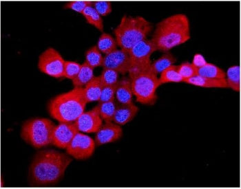 EDNRB Antibody