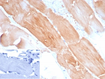 ACTN2 Antibody / Alpha Actinin 2 / Sarcomeric Alpha Actinin