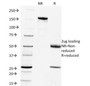 Rabies Virus Antibody