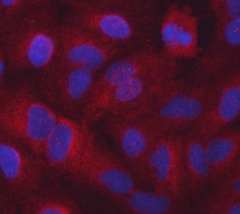 SARS1 Antibody / Seryl-tRNA synthetase / SERS