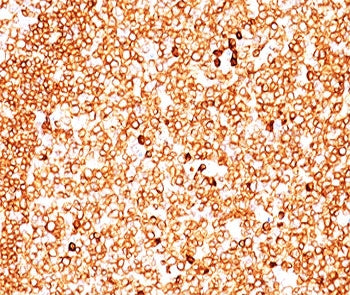 CD79a Antibody Cocktail