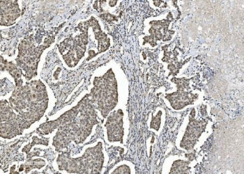 HDAC5 Antibody