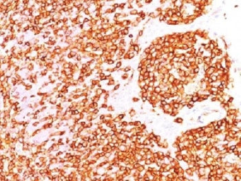 IHC test of FFPE human tonsil probed with CD45 antibody (clone PTPRC/1460). Required HIER: boil tiss