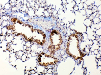 Mmp13 Antibody / Collagenase 3