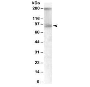 CDCP1 Antibody