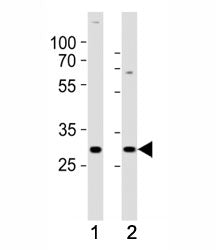 Western blot analysis of lysate from (1) SH-SY5Y and (2) MCF-7 cell line using HES1 antibody at 1:10