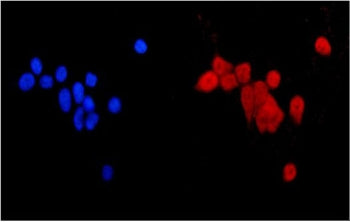 Immunofluorescent staining of FFPE human MCF7 cells with MGMT antibody (red) and DAPI nuclear stain