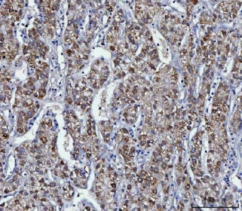 KMO Antibody / Kynurenine 3 monooxygenase