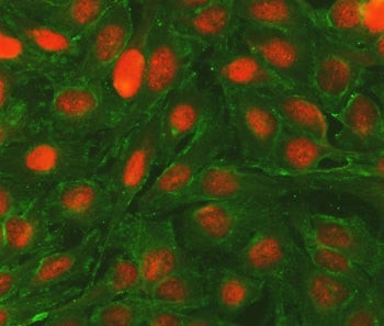Bcl-2 Antibody