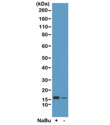 H2BK20ac Antibody / Acetyl Histone H2B Lysine 20