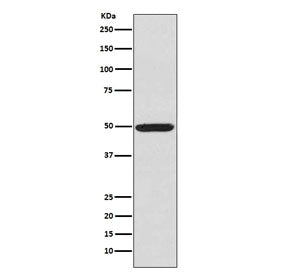 Phospho-PKA R2 Antibody / PRKAR2A (pS99)