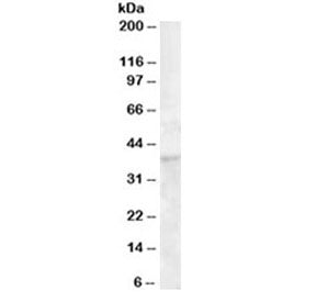 DKK1 Antibody
