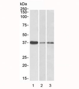 IL12B Antibody