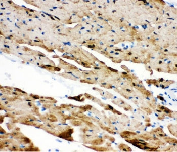 IHC staining of FFPE mouse heart tissue with PLN antibody. HIER: boil tissue sections in pH8 EDTA fo