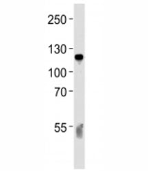 Complement C6 Antibody