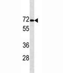 Estrogen Receptor alpha antibody western blot analysis in MCF-7 lysate. Predicted molecular weight:
