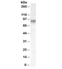 Factor XIIIa Antibody