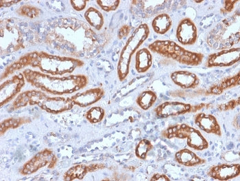 IHC staining of FFPE human spleen with recombinant CD61 antibody (clone rITGB3/1713). HIER: boil tis