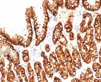 CA9 Antibody / Carbonic Anhydrase IX