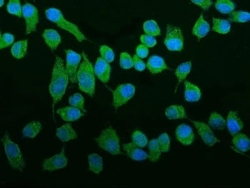 ROCK2 Antibody