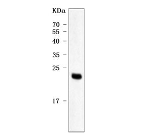 PP14 Antibody / Placental protein 14 / PAEP / ZIF-1