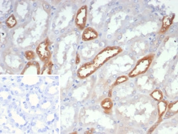 IHC staining of FFPE human kidney tissue with NDPK-B antibody (clone NME2/6436). Inset: PBS used in