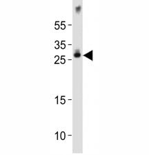 Western blot analysis of lysate from mouse brain tissue lysate using Olig1 antibody diluted at 1:100