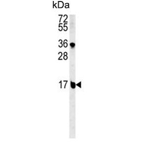 Western blot testing of mouse NIH 3T3 cell lysate with BLOC1S2 antibody. Predicted molecular weight