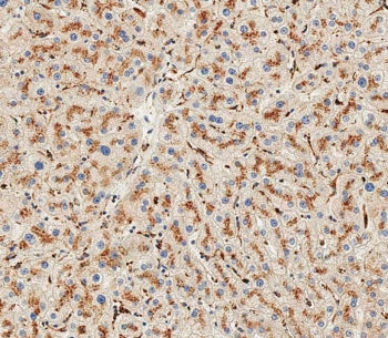 HEXA Antibody / Hexosaminidase A