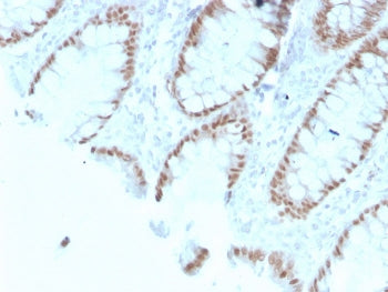 CDX2 Antibody