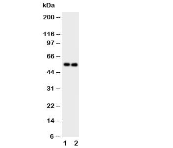 GABA A Receptor alpha 1 Antibody