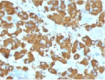 Growth Hormone Antibody / GH1