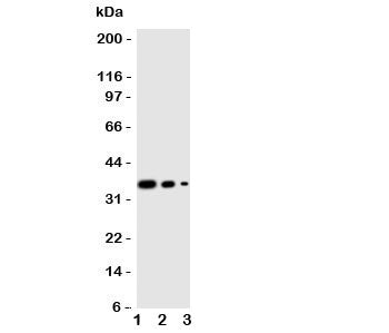 WNT2B Antibody
