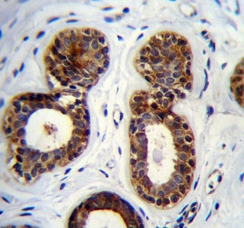 QTRTD1 Antibody / QTRT2