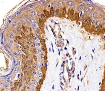 S100A2 Antibody
