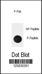 IkBa Antibody (phospho-Ser32))