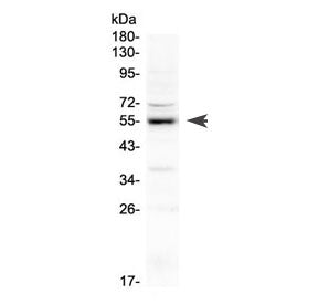Erythropoietin Receptor Antibody / EPOR
