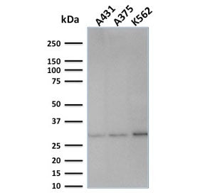 RPA32 Antibody / Replication Protein A2