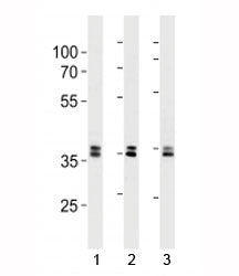 UCH37 antibody western blot analysis in 293, HeLa, 293T lysate. Predicted molecular weight ~37 kDa (
