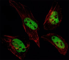 Fluorescent image of HeLa cells stained with SUMO antibody at 1:25. SUMO1 immunoreactivity is locali