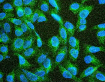 TIE2 Antibody / TEK
