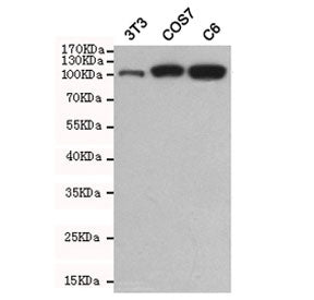 Hexokinase 2 Antibody
