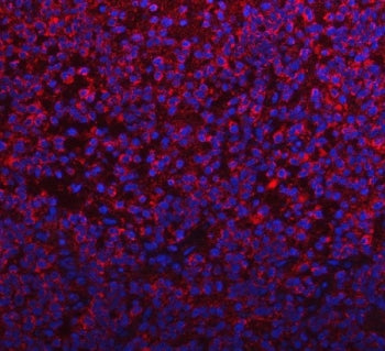 PYCR1 Antibody / Pyrroline-5-carboxylate reductase 1