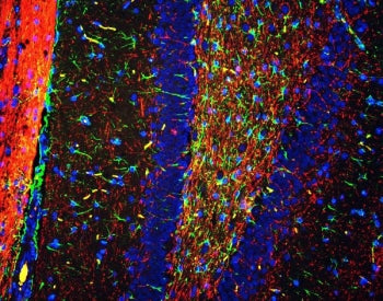 GFAP Antibody / Glial Fibrillary Acidic Protein