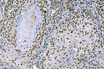 Ki-67 antibody