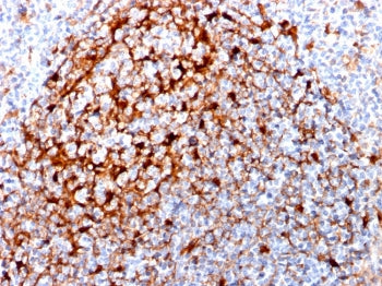 Cystatin A Antibody / CSTA
