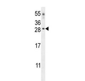 Western blot testing of mouse heart tissue lysate with Claudin 6 antibody. Predicted molecular weight ~23 kDa.